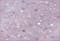 Плитка ALMA CERAMICA облицовочная Lila на роз фиолет 249*364*7,5 1,36м2 54к TWU07LIL503/7ПОЛЛ503 - фото 21627
